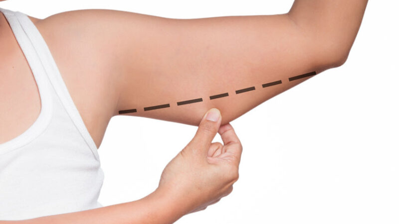 65812809 - asian woman checking her upper arm